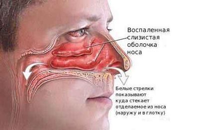 комплекс комплекс